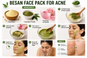 Besan Face Pack for Acne
